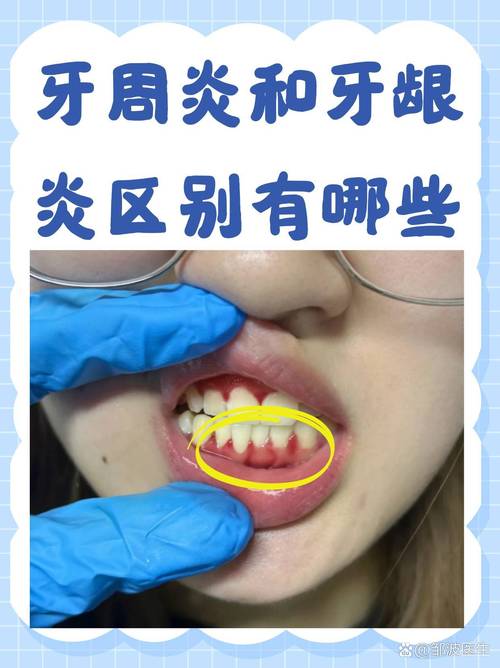 牙龈是什么部位