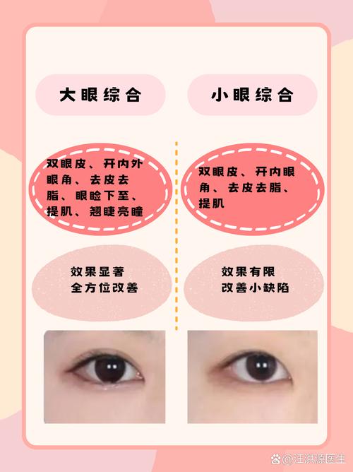 眼综合包括什么