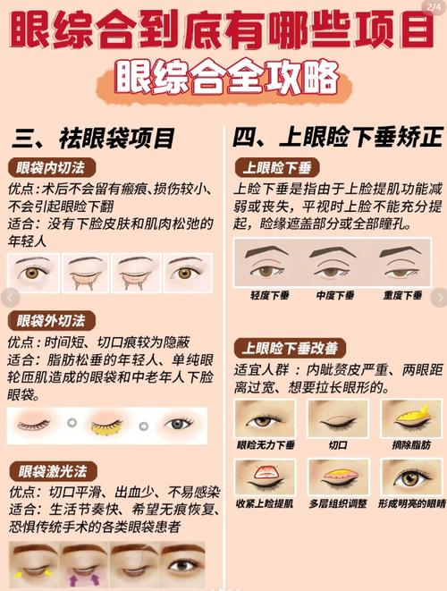 眼综合包括什么