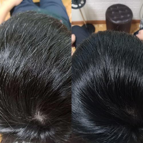 头发为什么长的慢