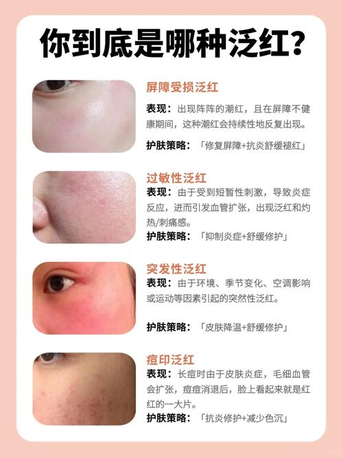 脸为什么会发红发烫