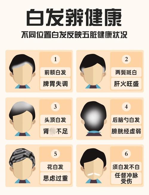 有白头发是缺什么