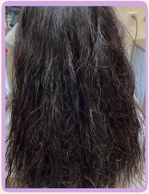 为什么头发会自然卷