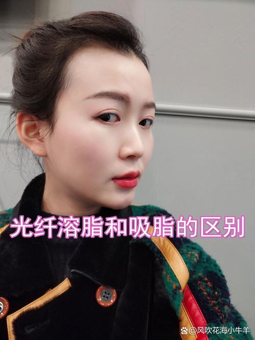 问一下光纤溶脂减肥是什么