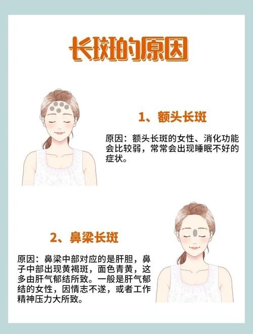 为什么脸上有雀斑