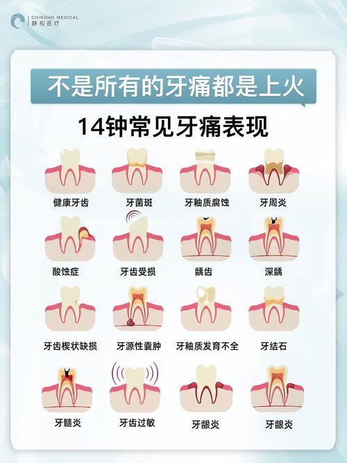 牙龈酸痛是什么原因
