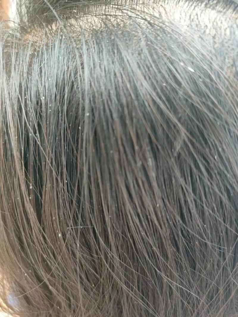 头发发亮是什么原因