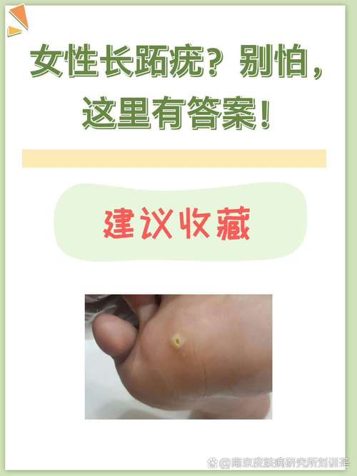 跖疣有什么危害