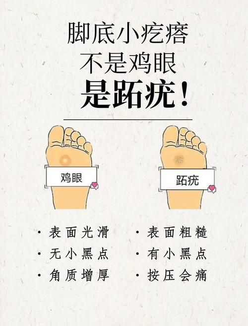 跖疣有什么危害