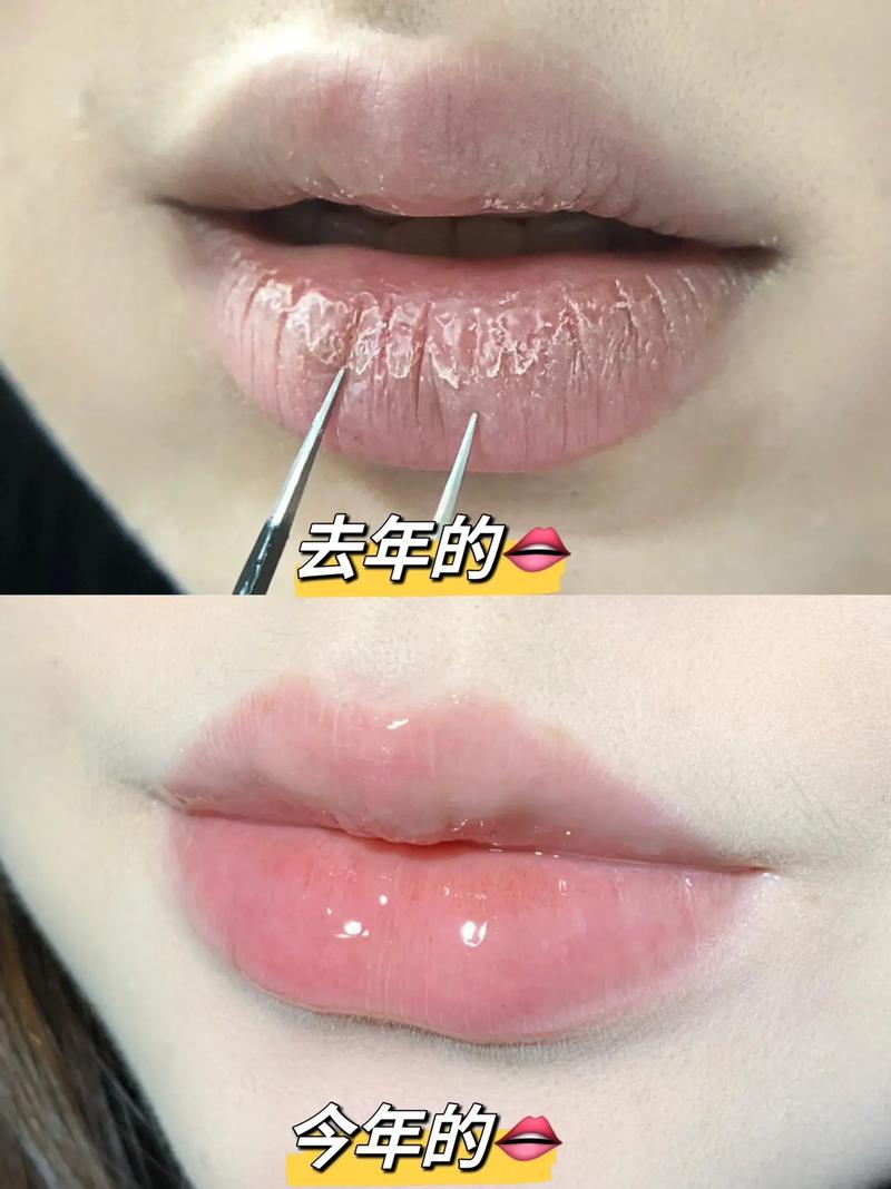 嘴唇干裂涂什么好