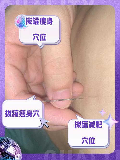 拔罐什么位置可以减肥