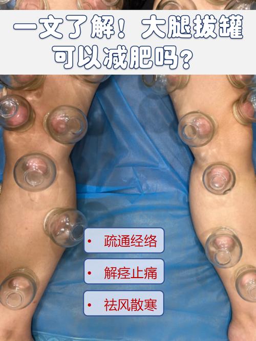 拔罐能减肥的原理是什么