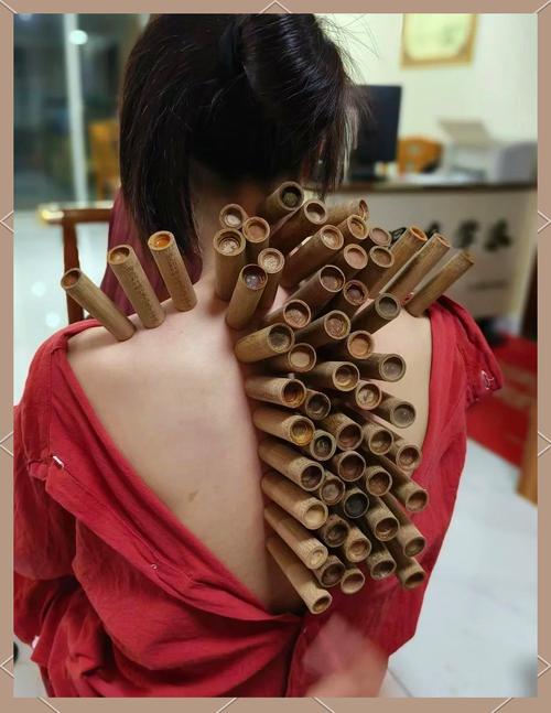 拔罐减肥用什么药养罐