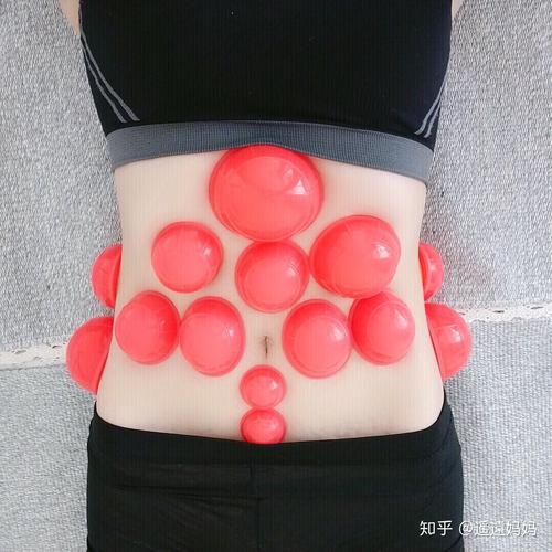 拔罐减肥时可以吃什么