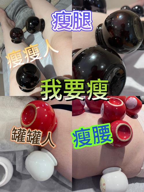 拔罐减肥前需要涂什么