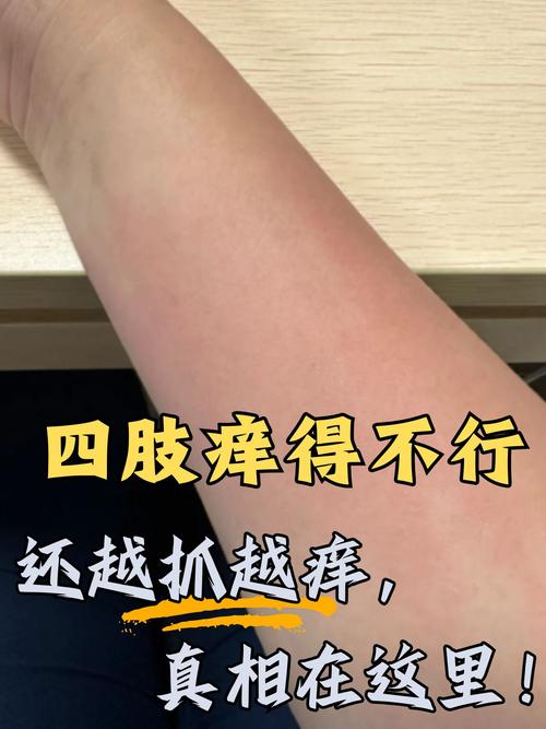 为什么皮肤越抓越痒