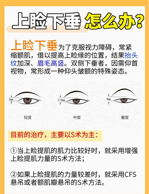 眼皮下垂是什么原因