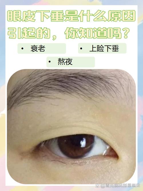 眼皮下垂是什么原因
