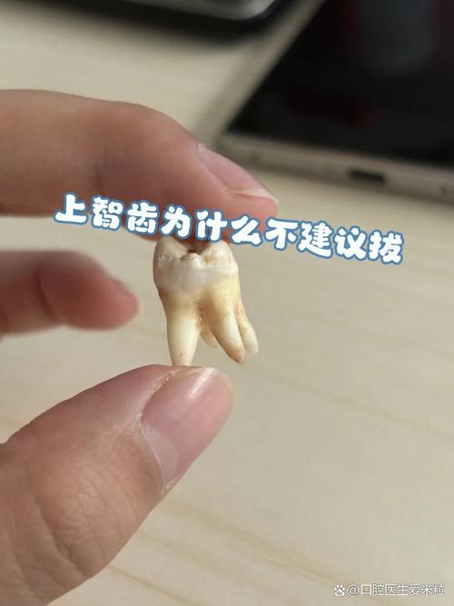 什么情况需要拔智齿