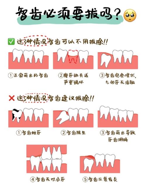 什么情况需要拔智齿
