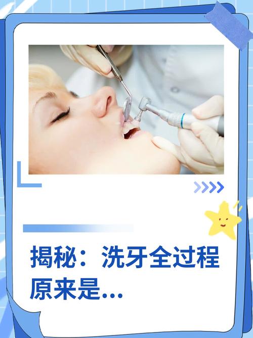 洗牙的原理是什么