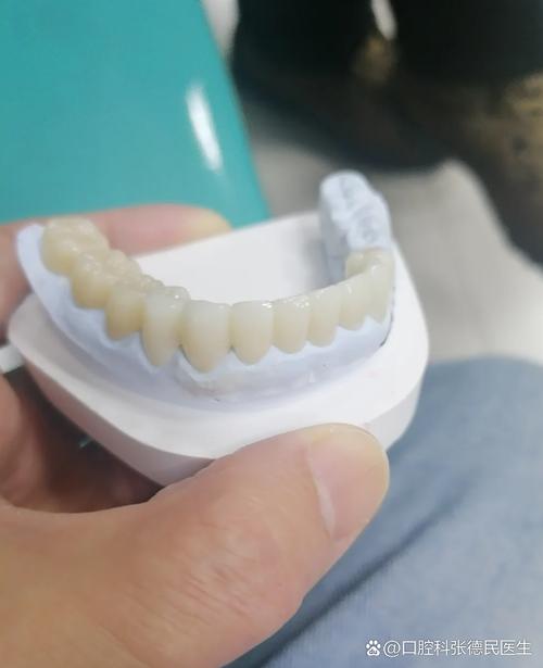 种植牙什么材质好