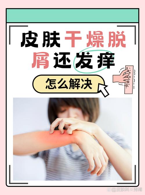 为什么皮肤干燥会痒