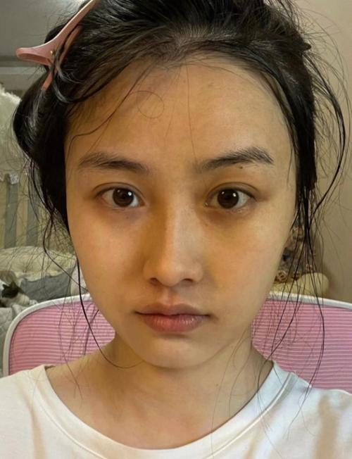 皮肤为什么越来越黄