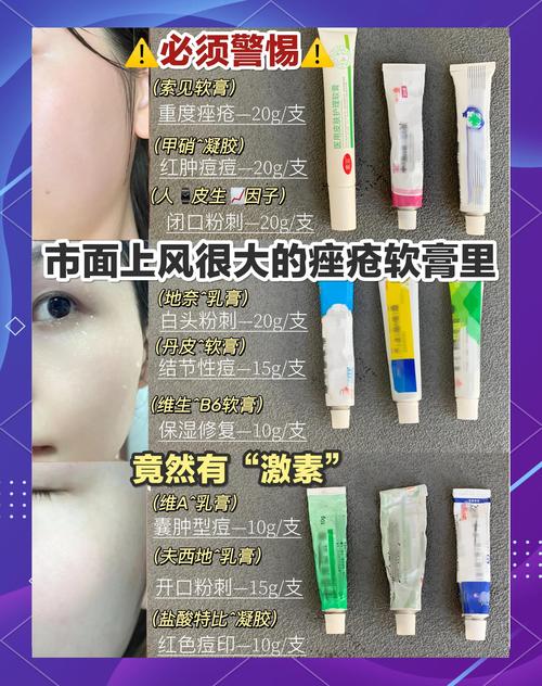 脸上有痘痘用什么药