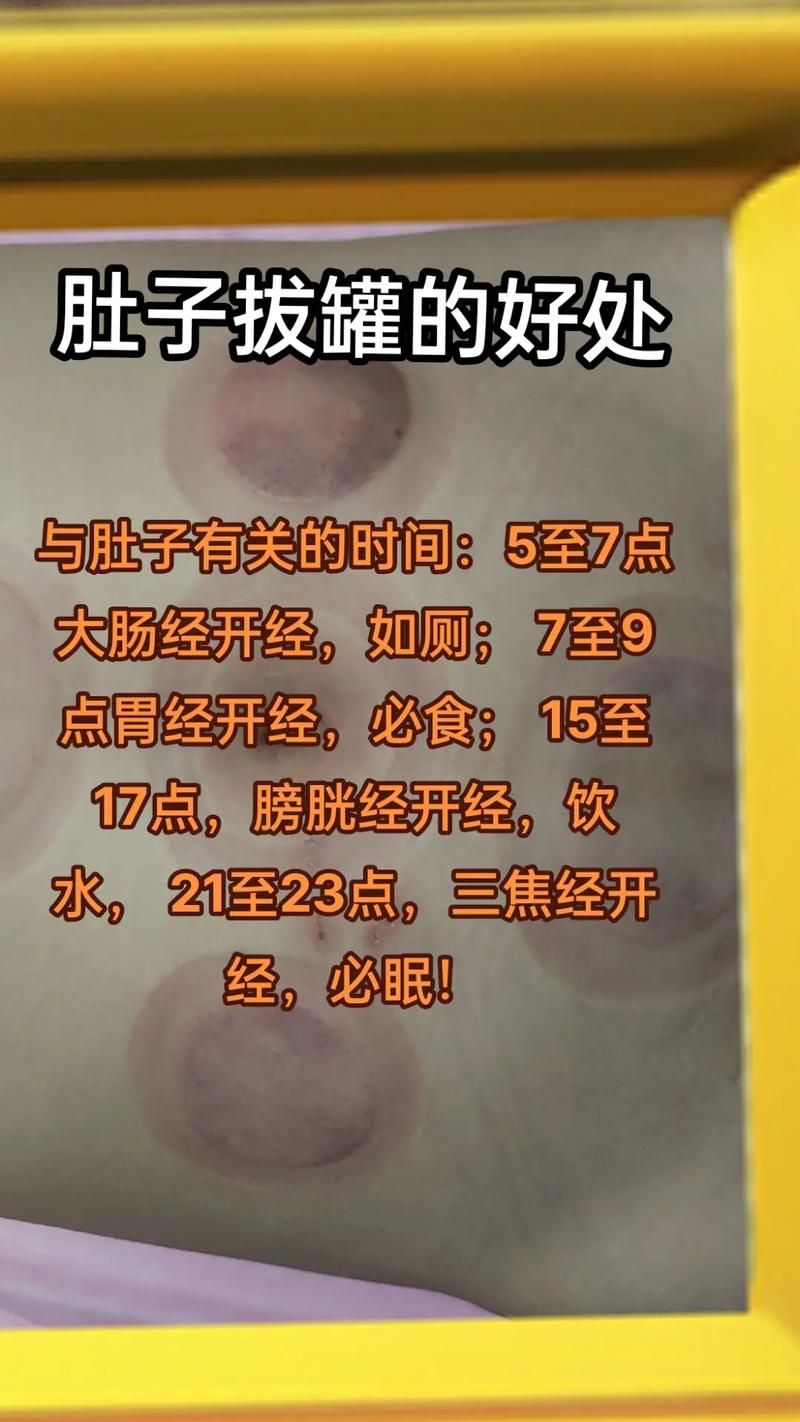 拔罐减肥为什么瘦的快