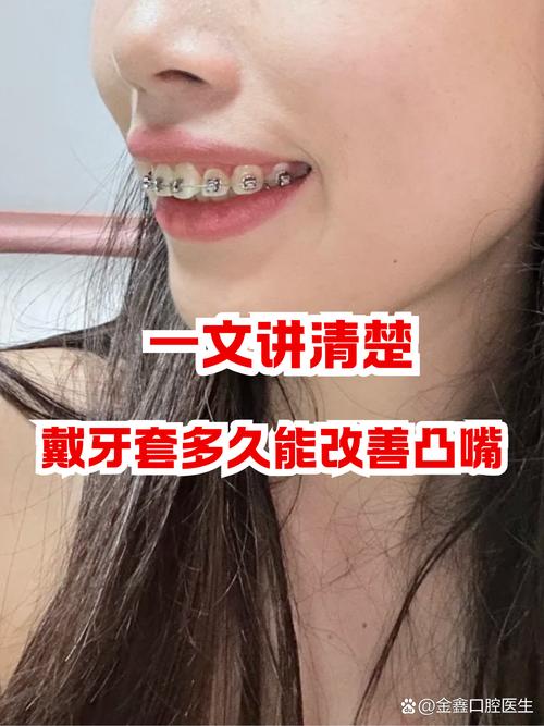 带牙套有什么影响