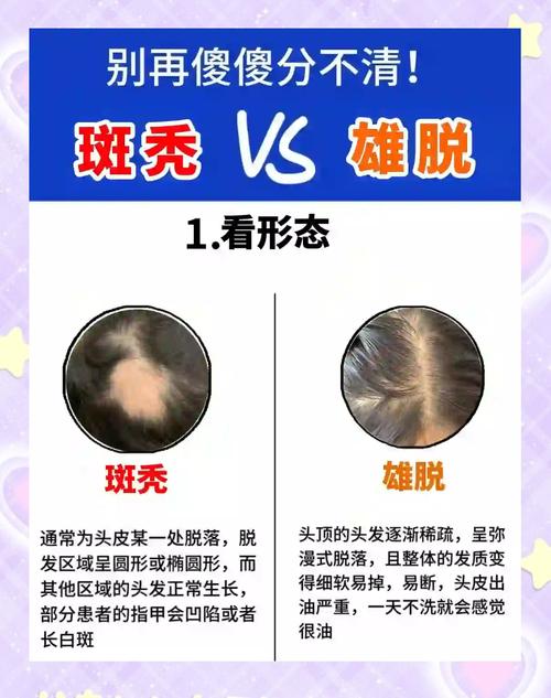 秃头是什么遗传