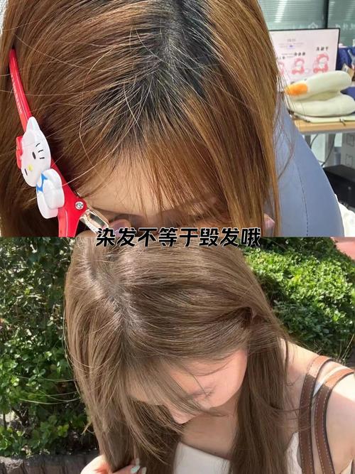 头发为什么会发黄