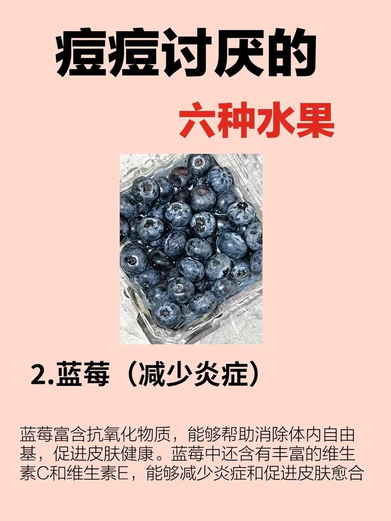 痤疮能吃什么水果