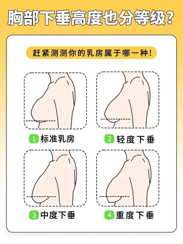 减肥为什么会胸下垂