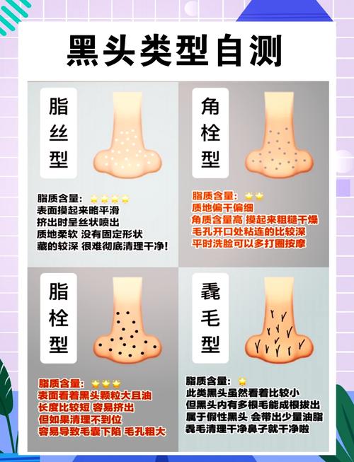 什么可以去黑头粉刺