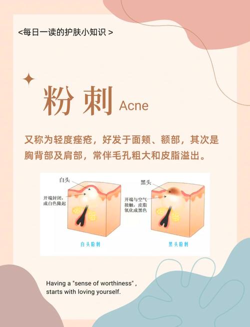 什么可以去黑头粉刺