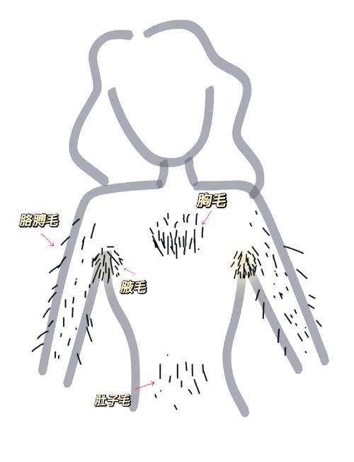什么方法永久脱毛