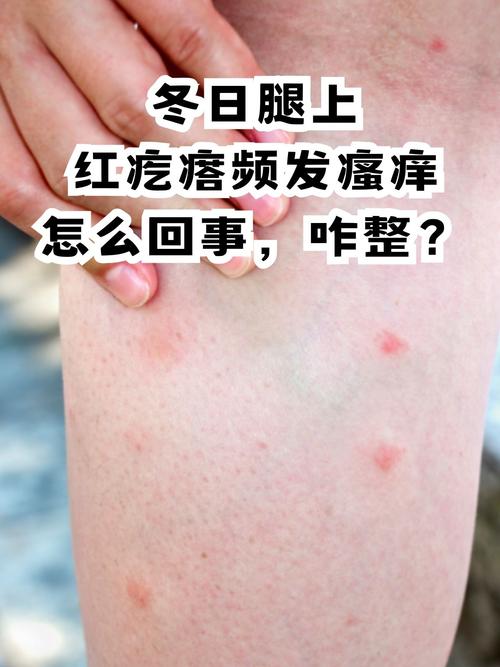 冬天皮肤为什么会痒