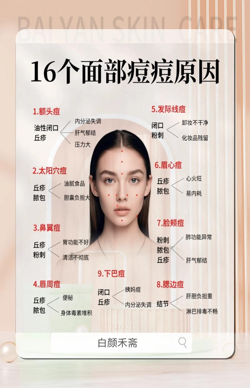 脸颊长痘是为什么