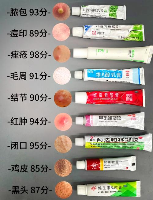 什么对痘痘有效