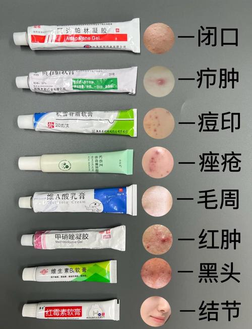 什么对痘痘有效