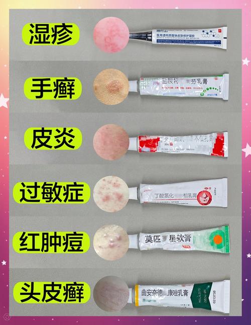 脸上过敏擦什么好