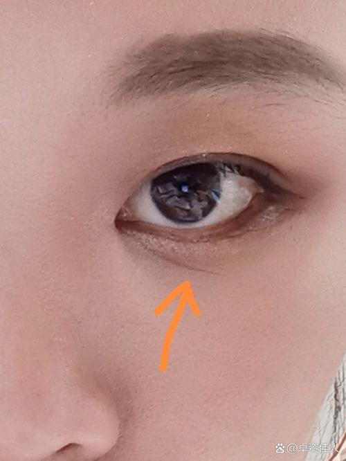 眼睛下面是什么纹