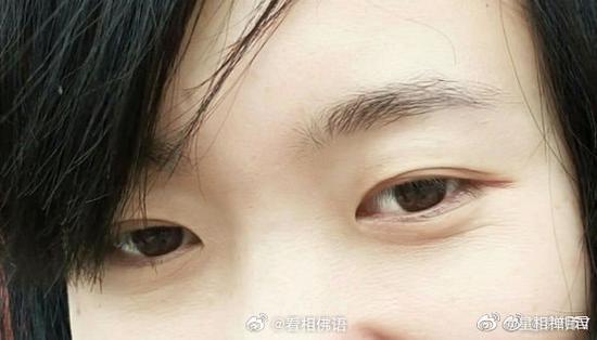 眼睛下面是什么纹