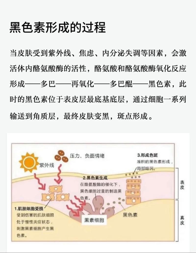 长老年斑是什么原因