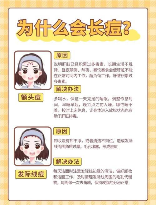 长痤疮的原因是什么