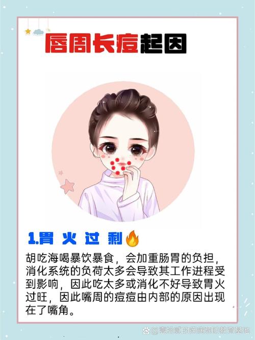 嘴巴长痘痘是什么原因