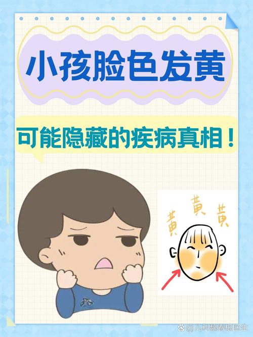 脸黄是因为什么