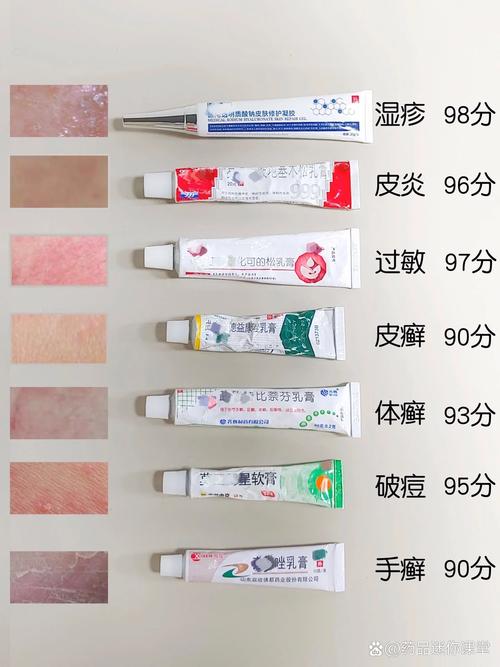 湿疹有什么治疗方法